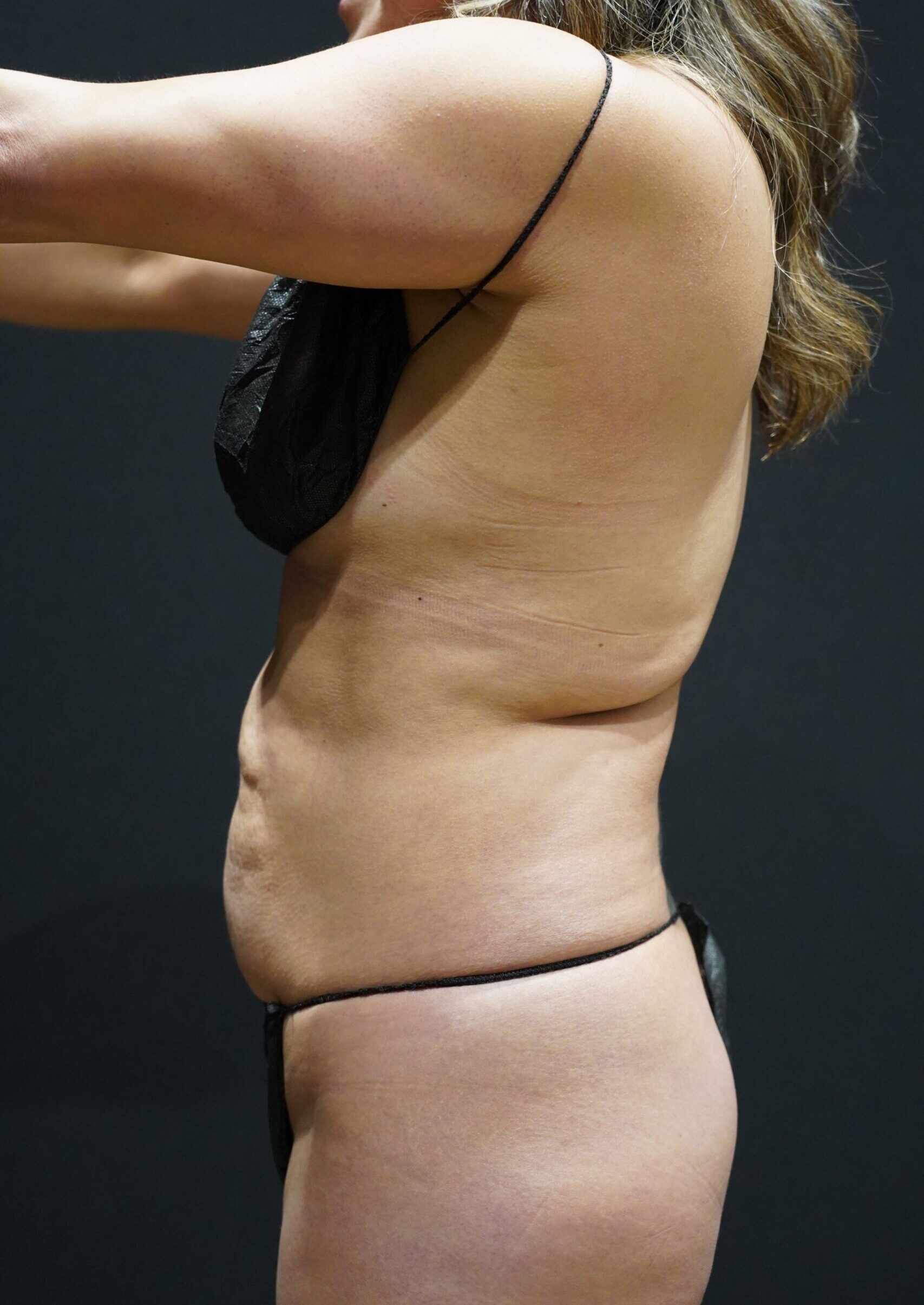 Before photo - -90° view