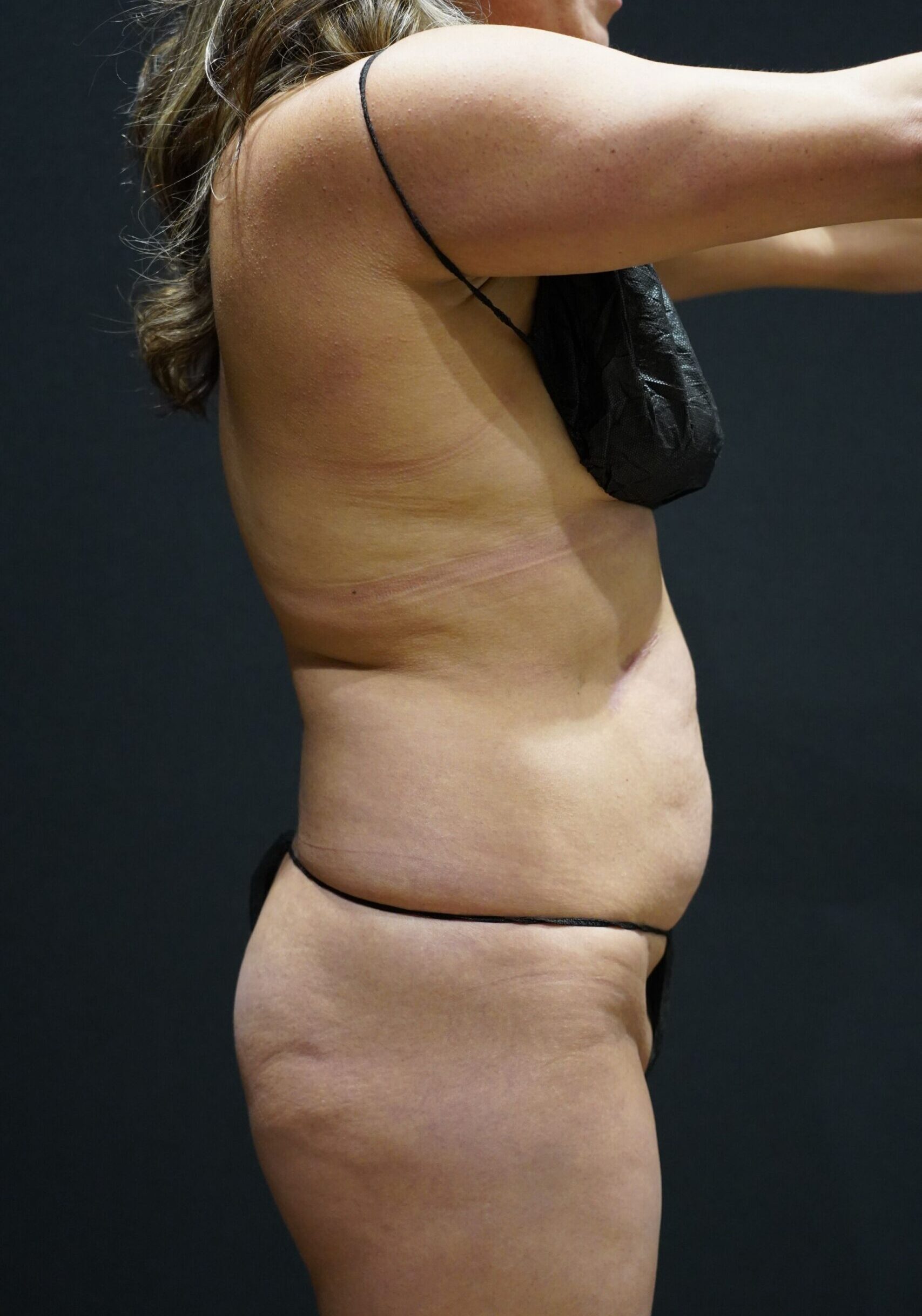 Before photo - 90° view