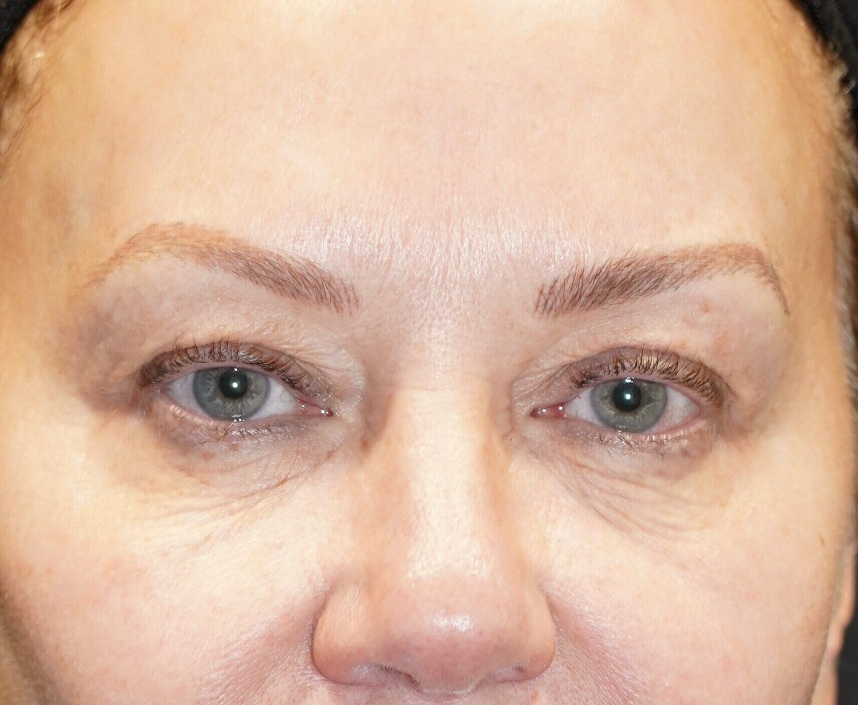 Before photo - 0° view