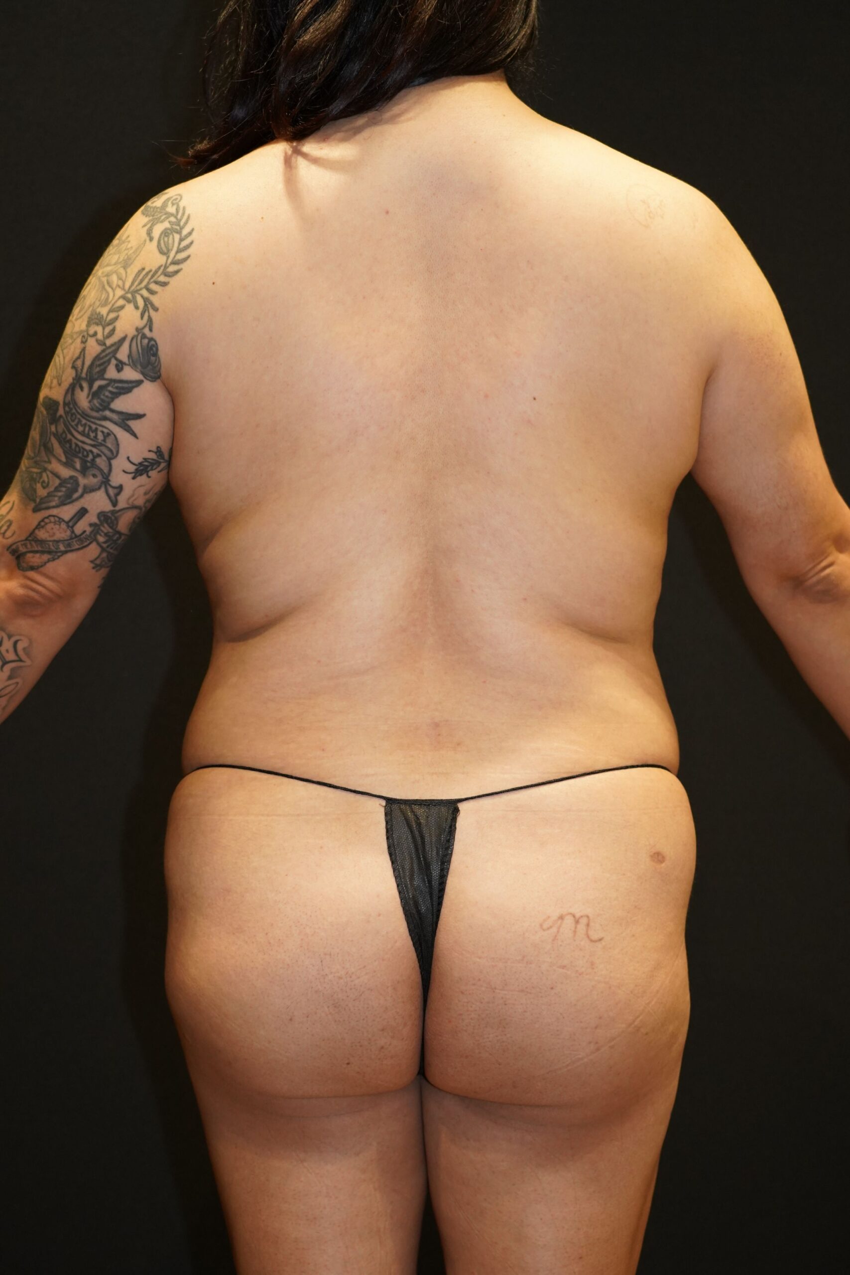 Before photo - 180° view