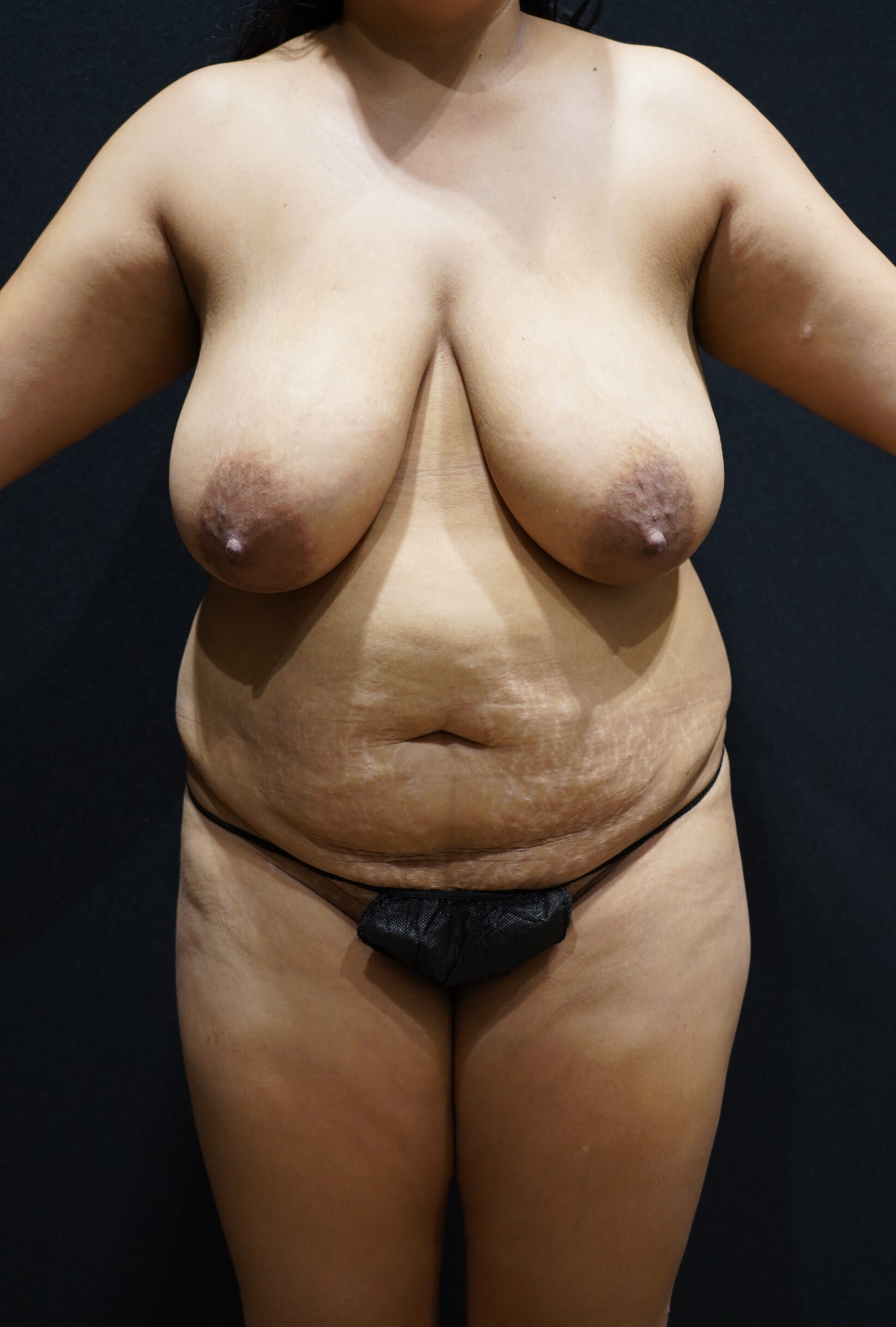 Before photo - 0° view