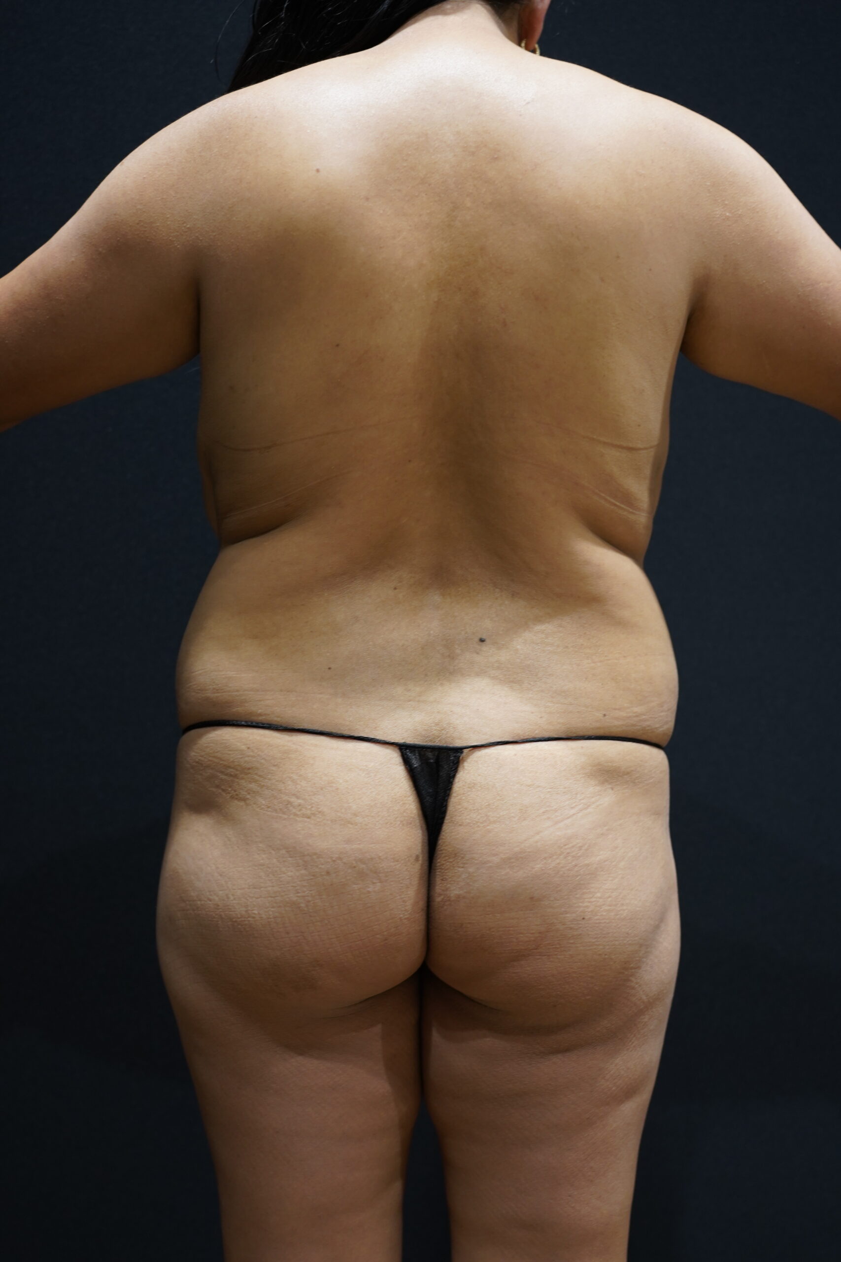 Before photo - 180° view