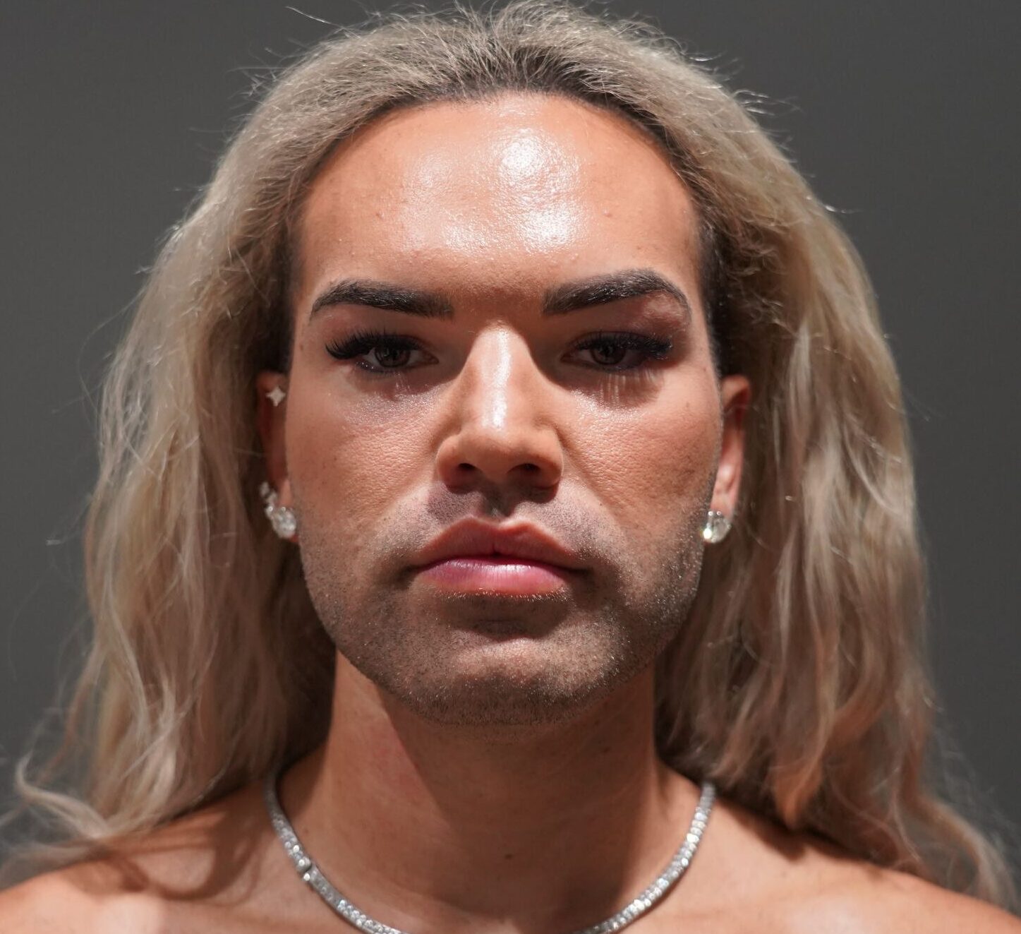 Before photo - 0° view