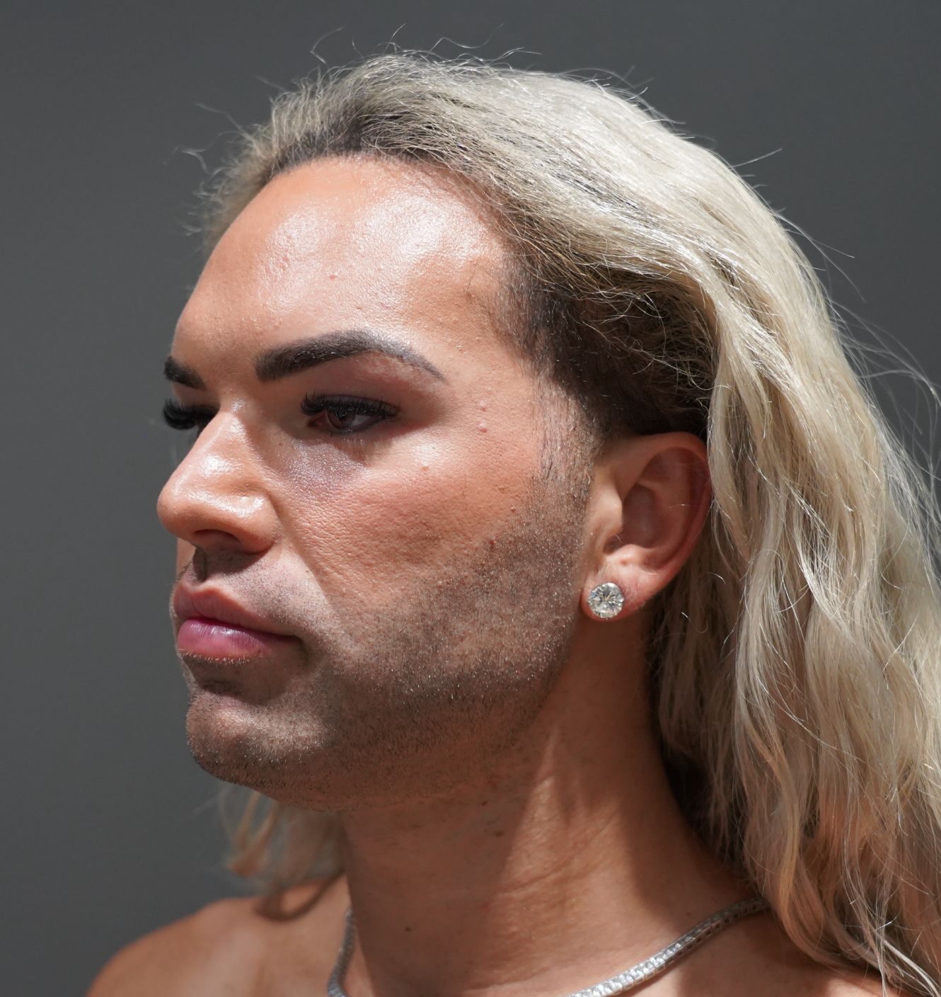 Before photo - -45° view