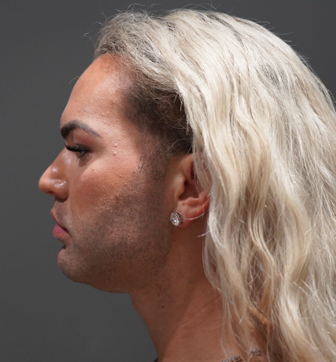 Before photo - -90° view