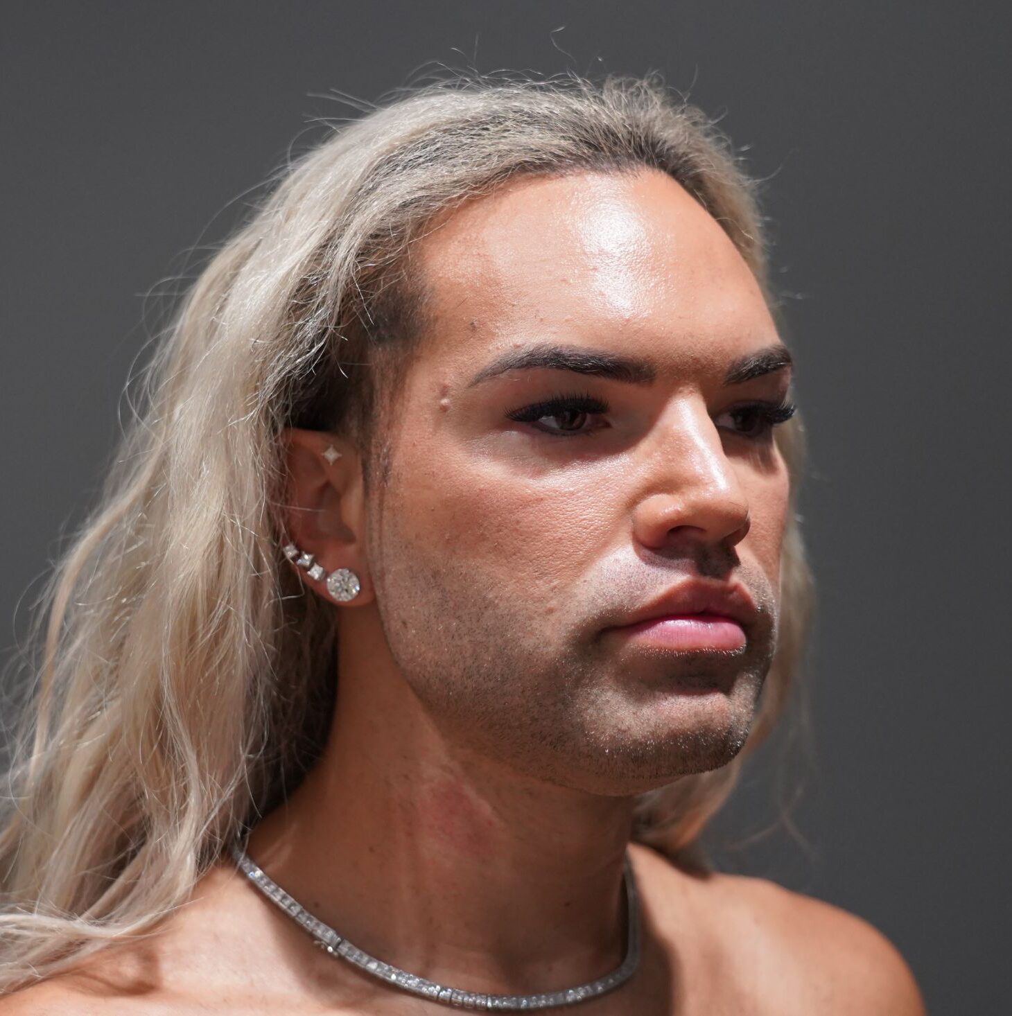 Before photo - 45° view