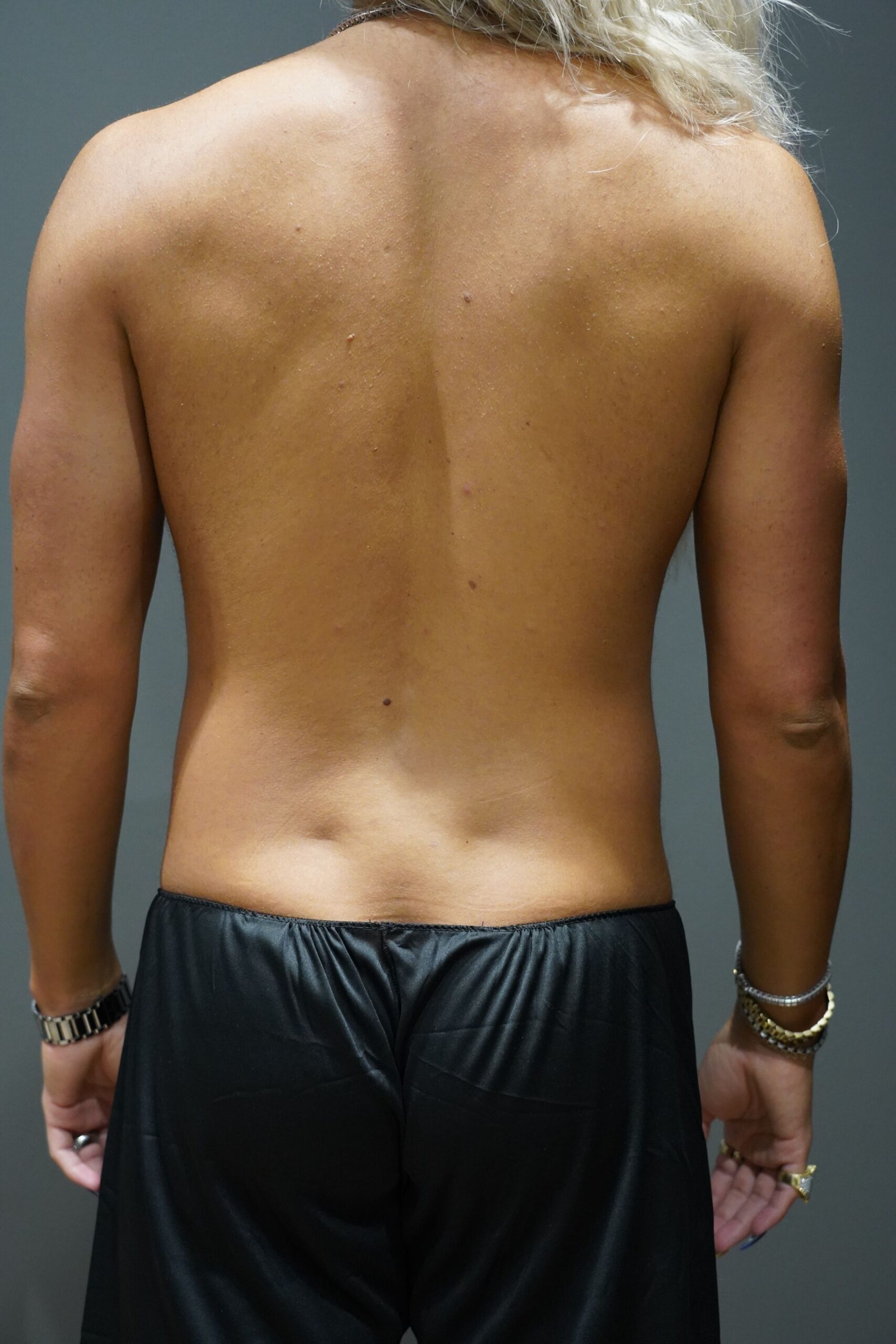 Before photo - 180° view