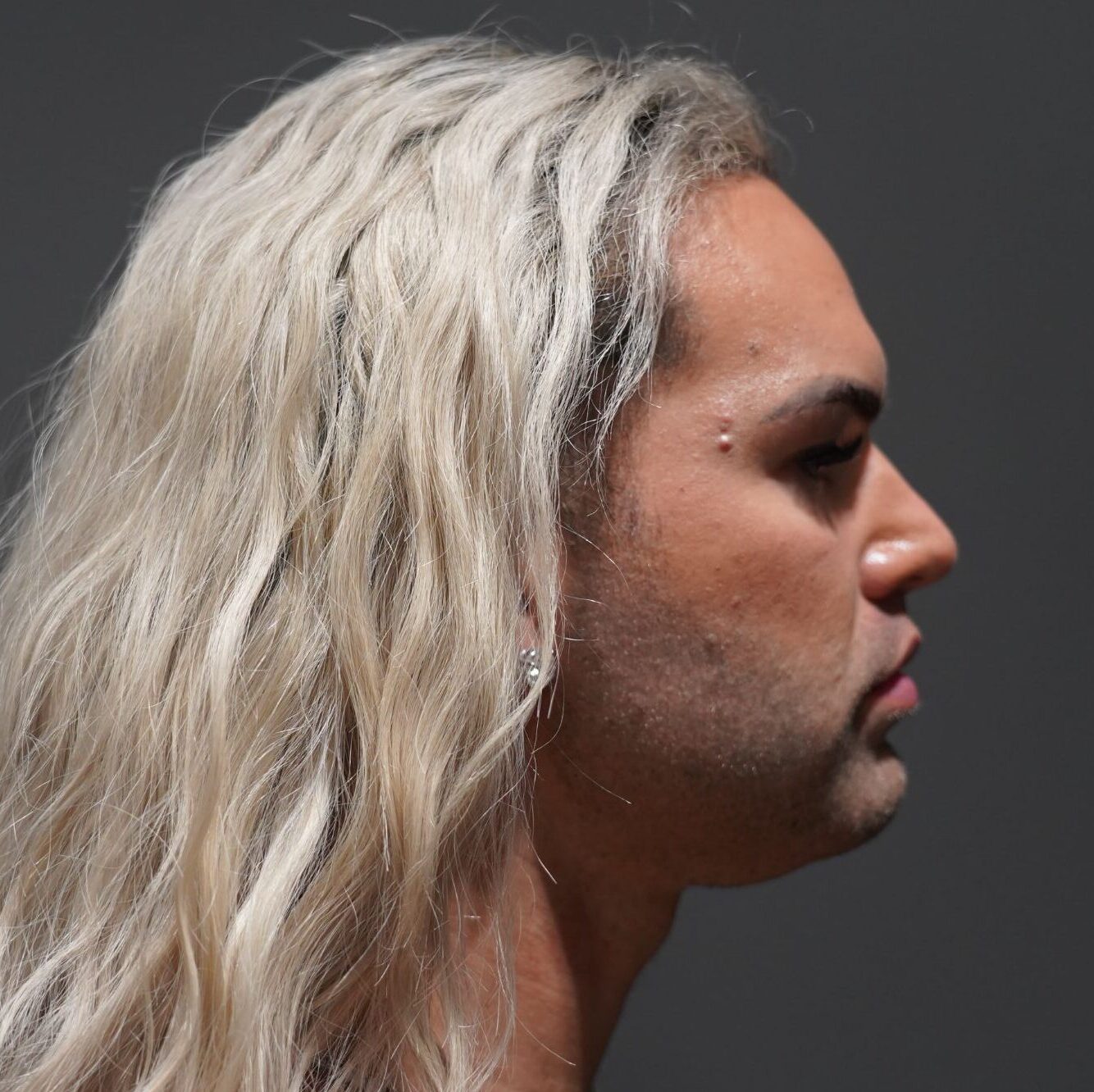 Before photo - 90° view