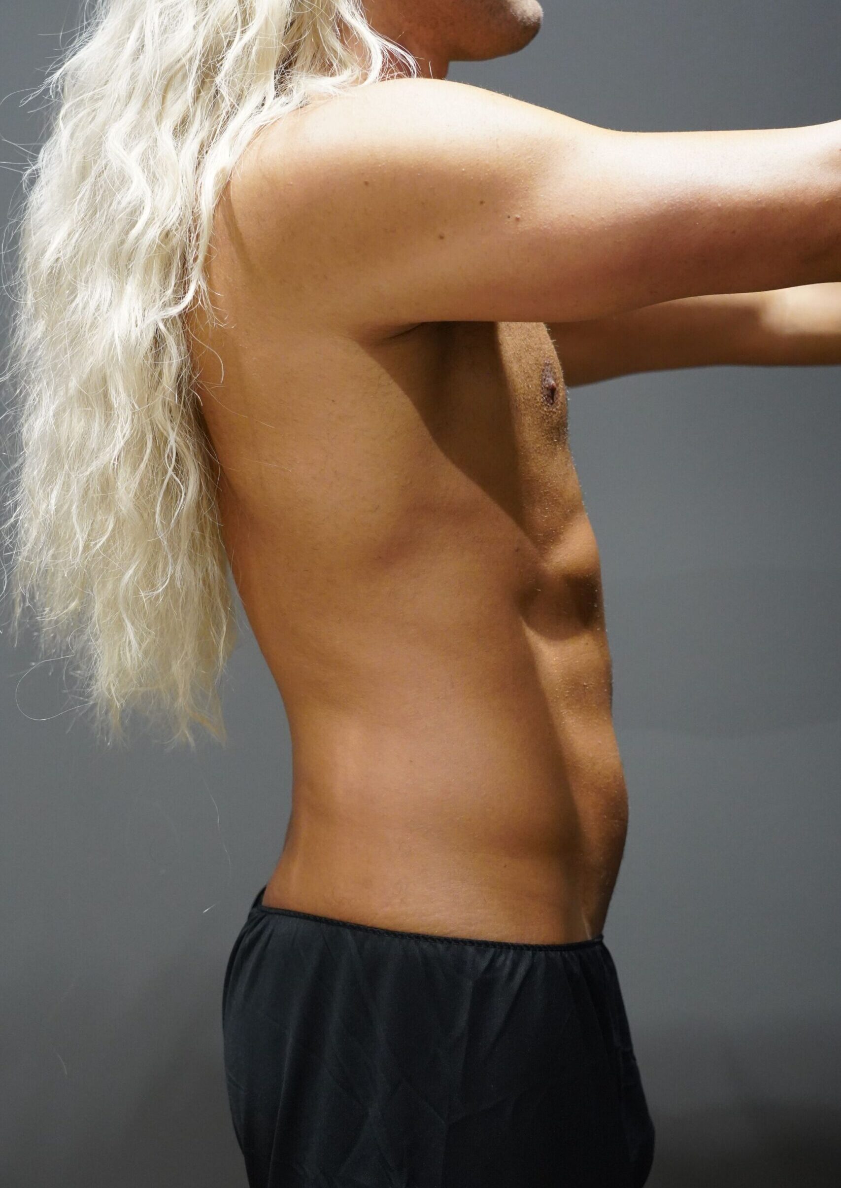 Before photo - 90° view