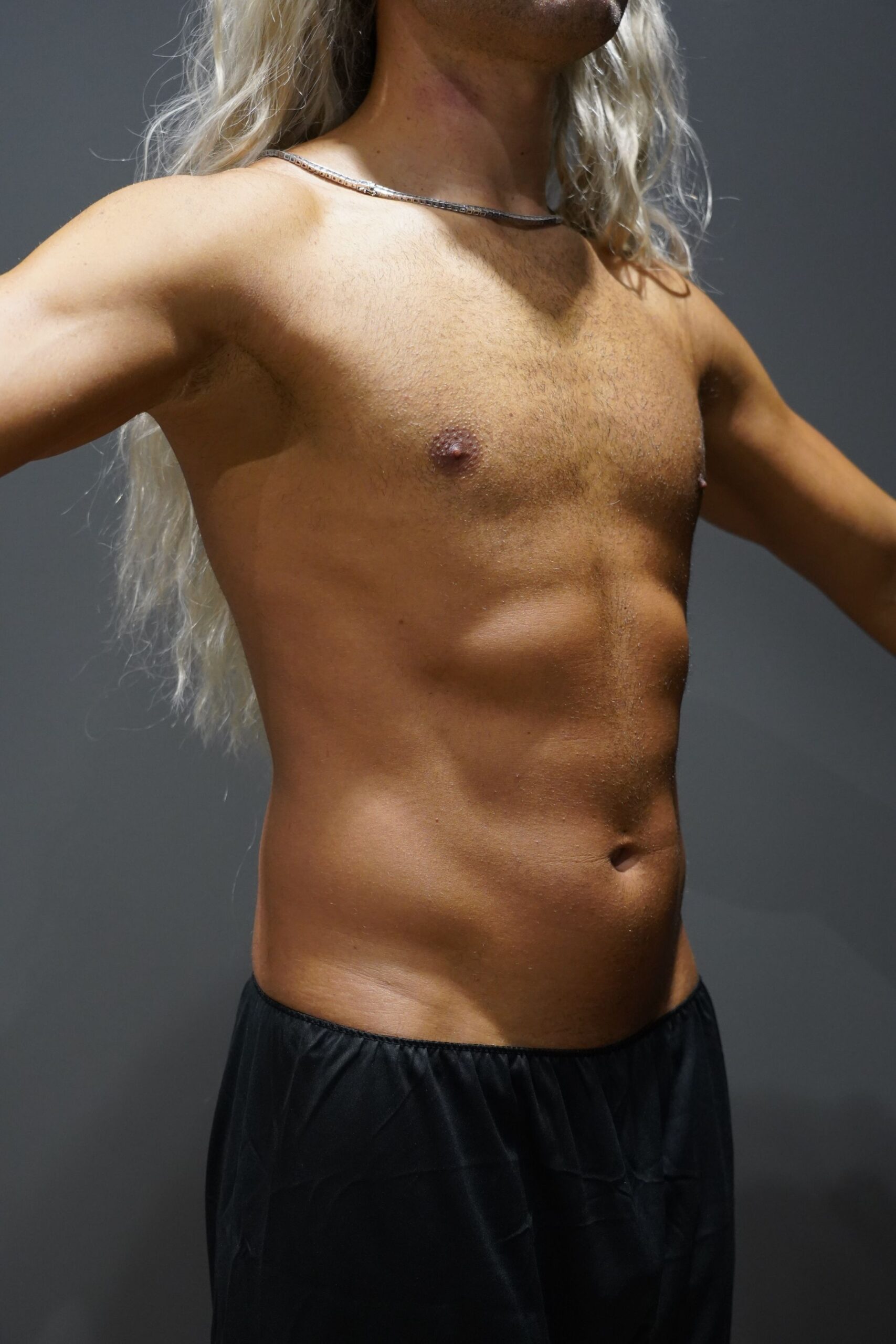 Before photo - 45° view