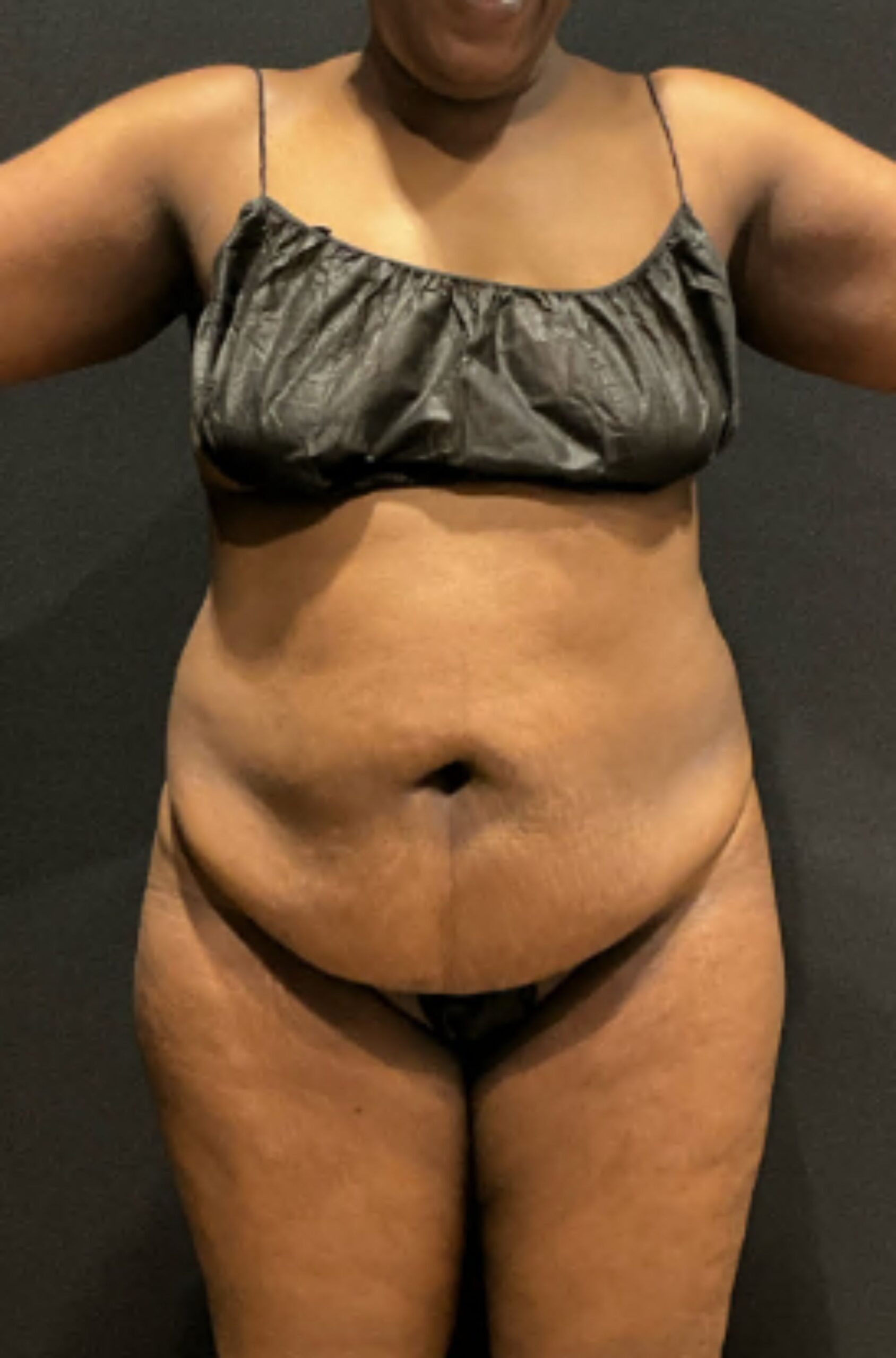 Before photo - 0° view