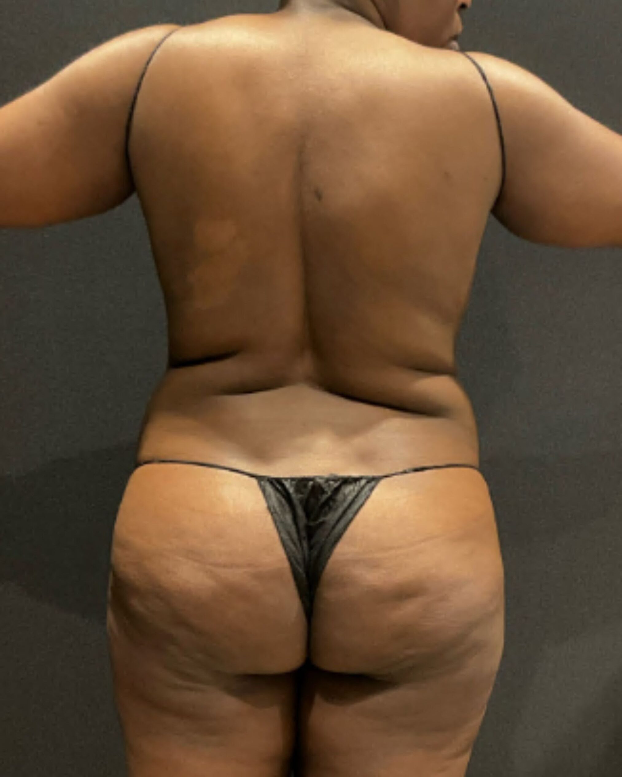 Before photo - 180° view