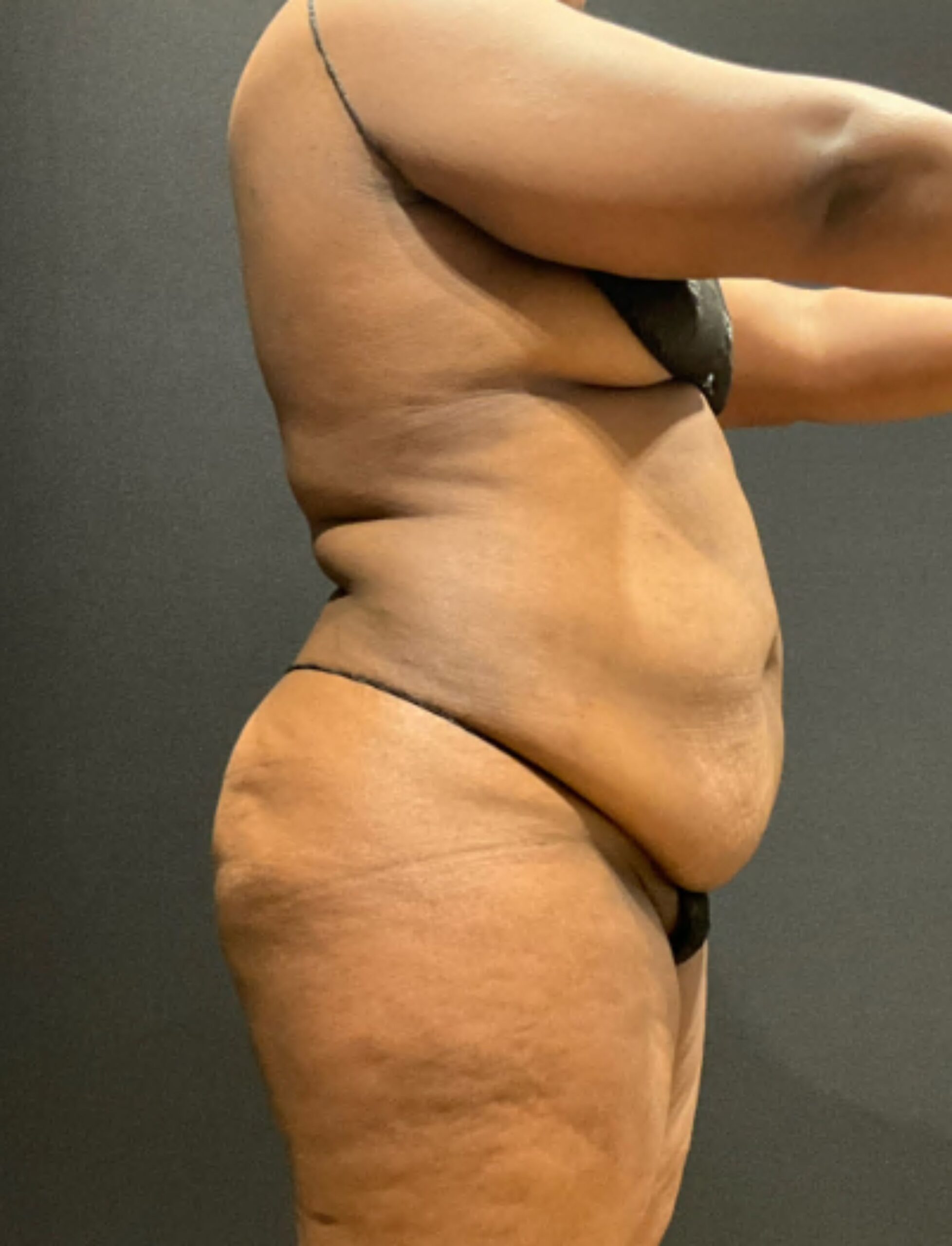 Before photo - 90° view