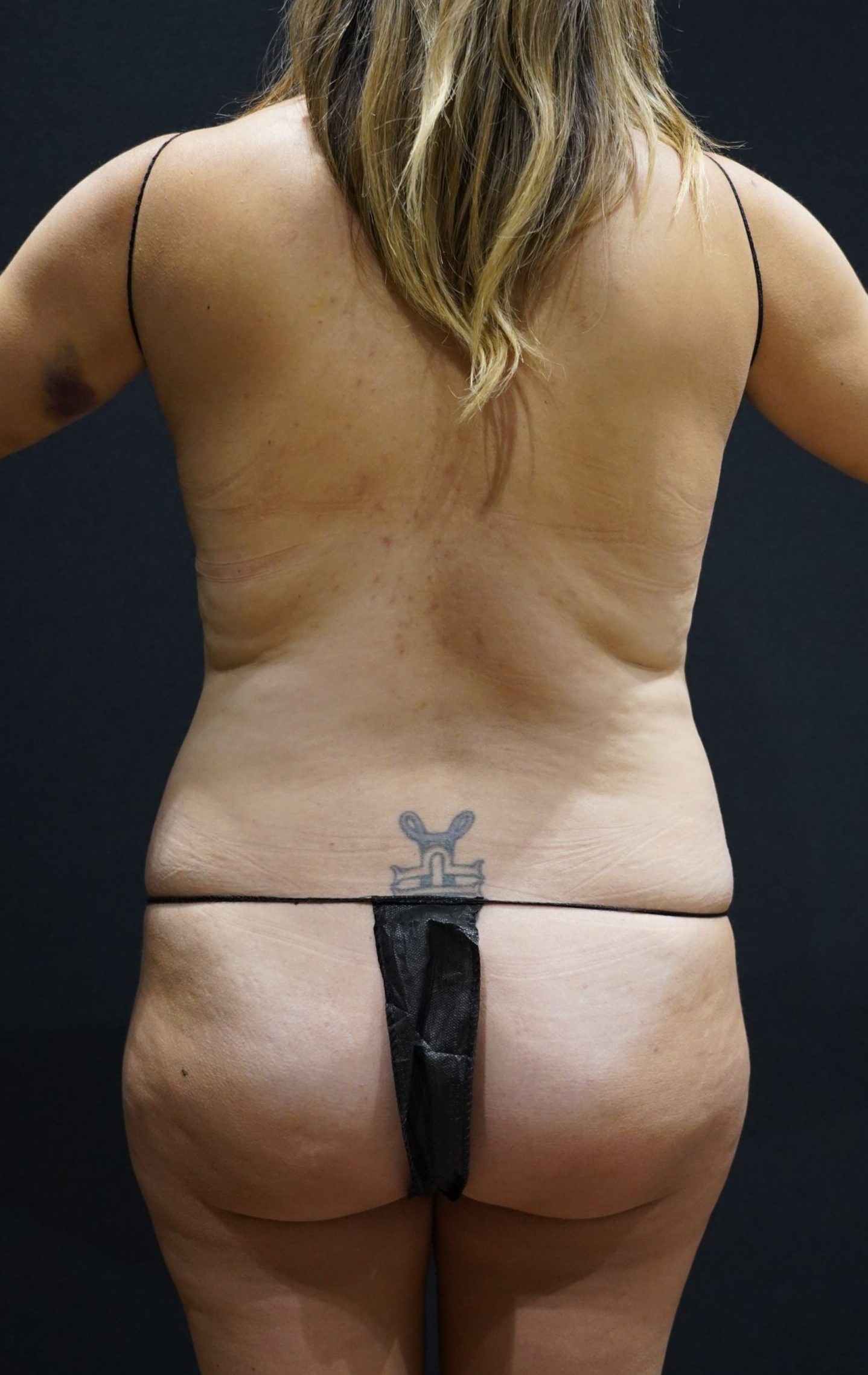 Before photo - 180° view