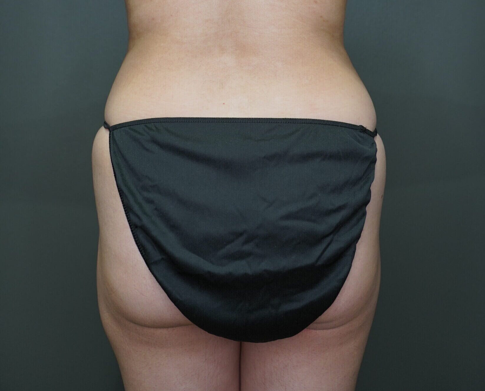 Before photo - 180° view