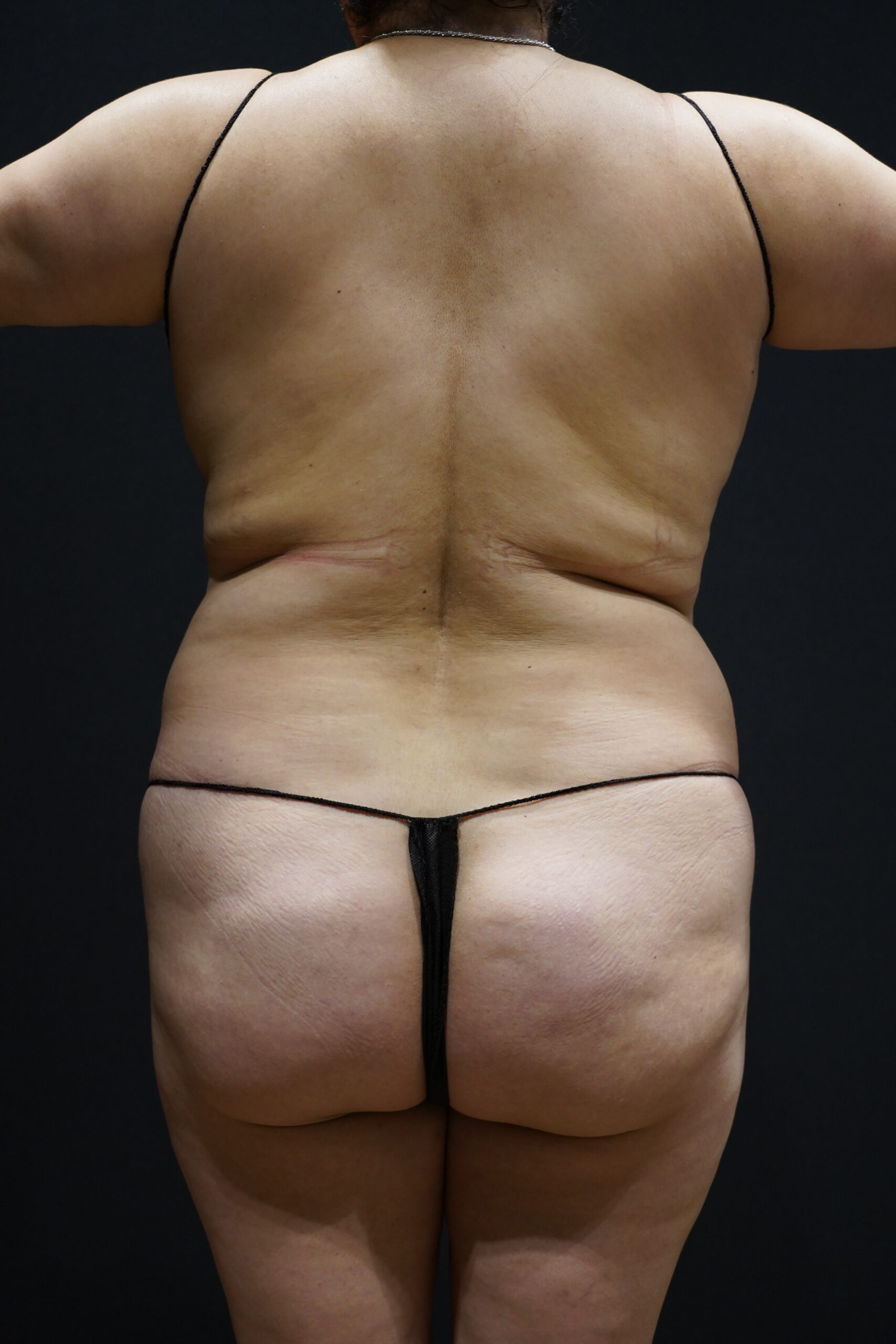 Before photo - 180° view