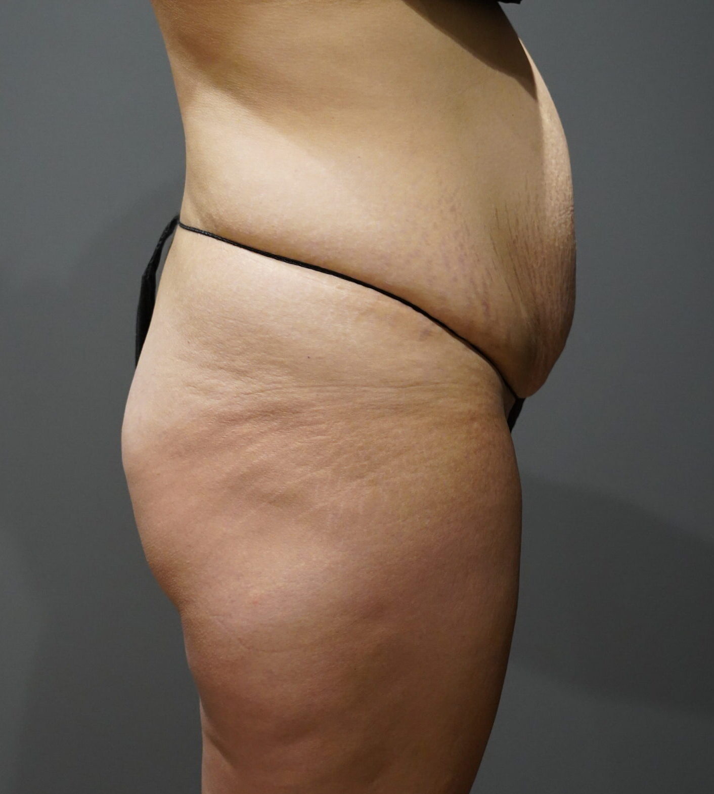 Before photo - 90° view