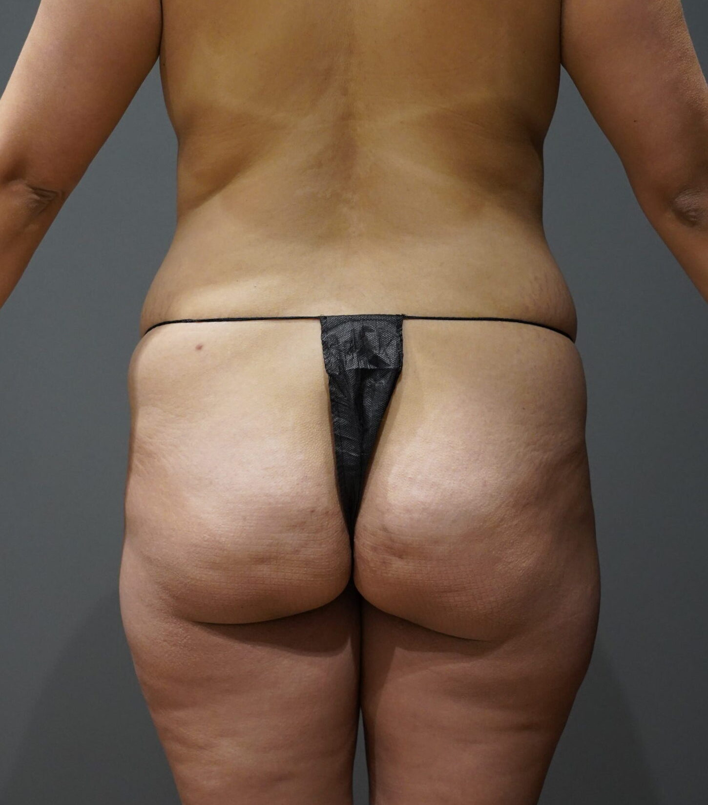 Before photo - 180° view