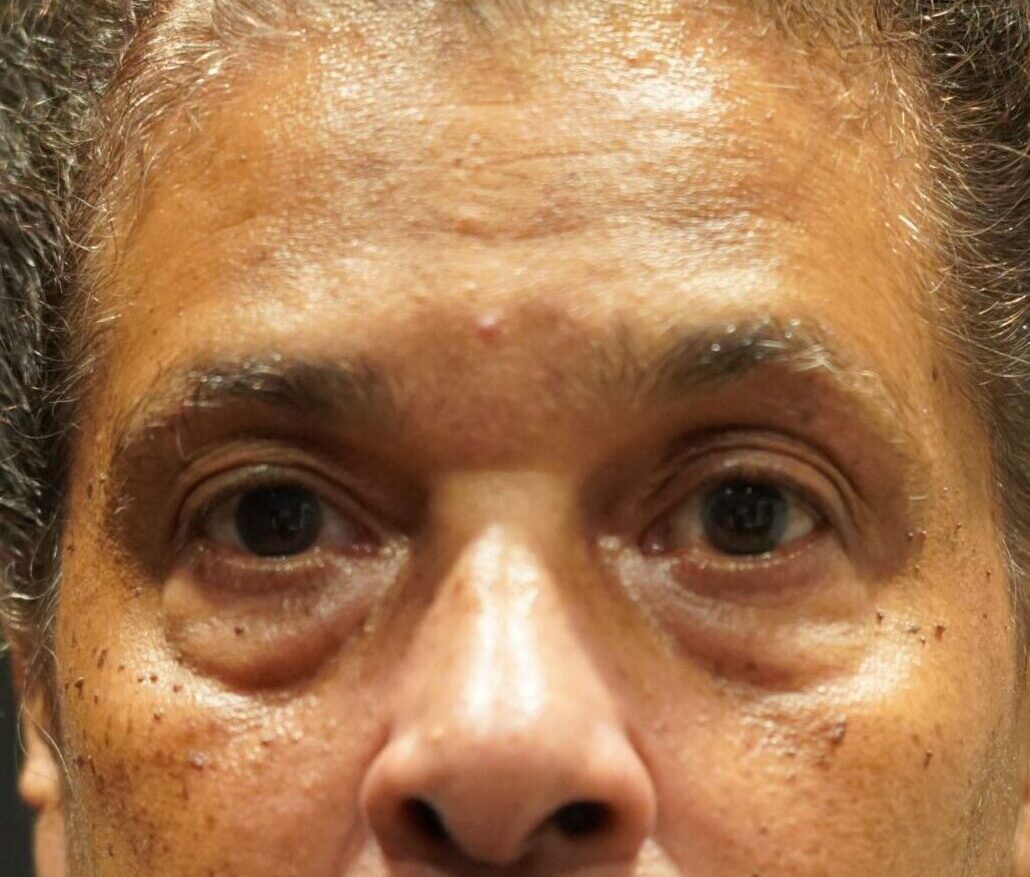 Before photo - 0° view