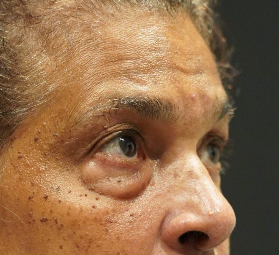 Before photo - 45° view