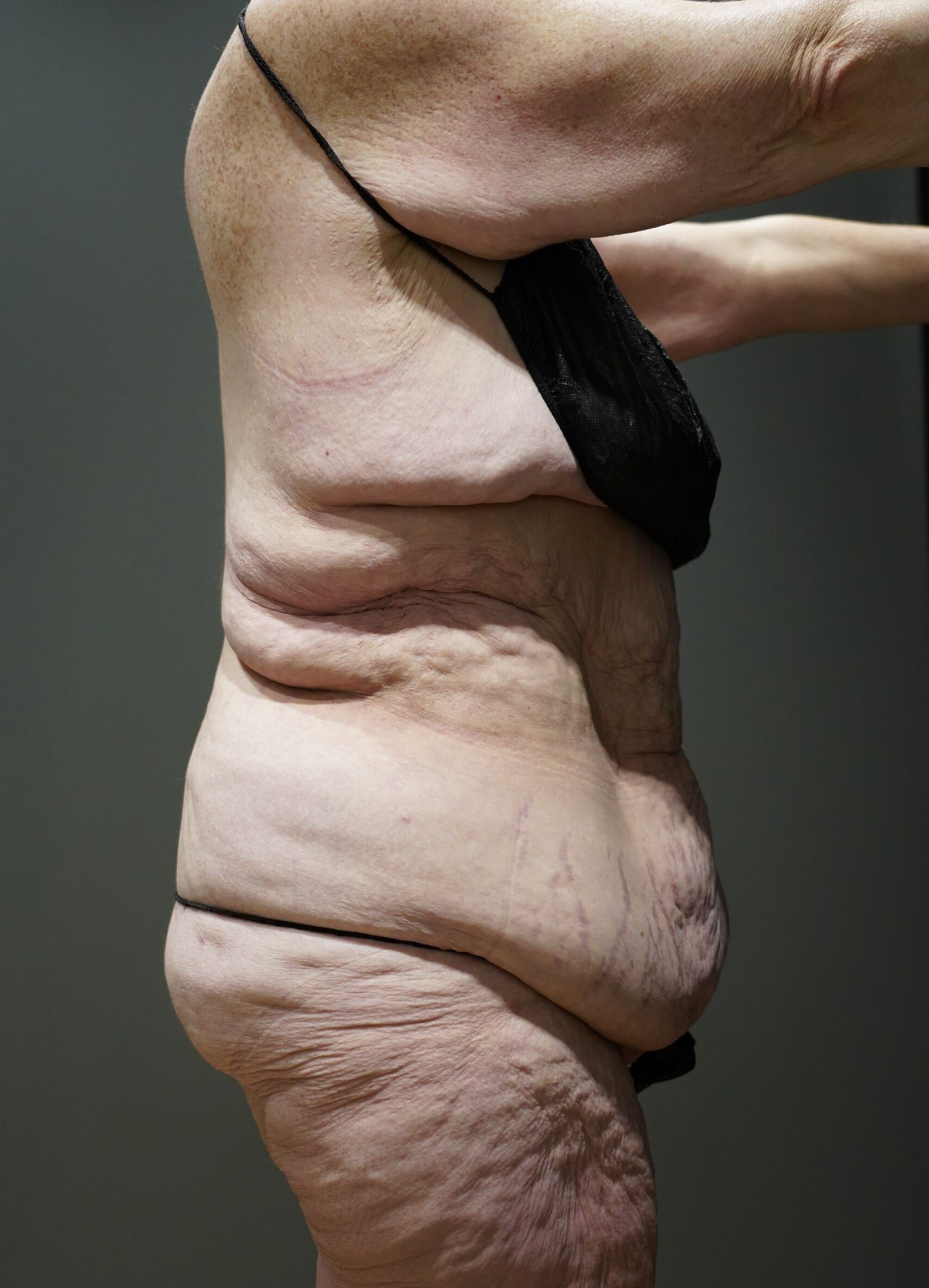 Before photo - 90° view