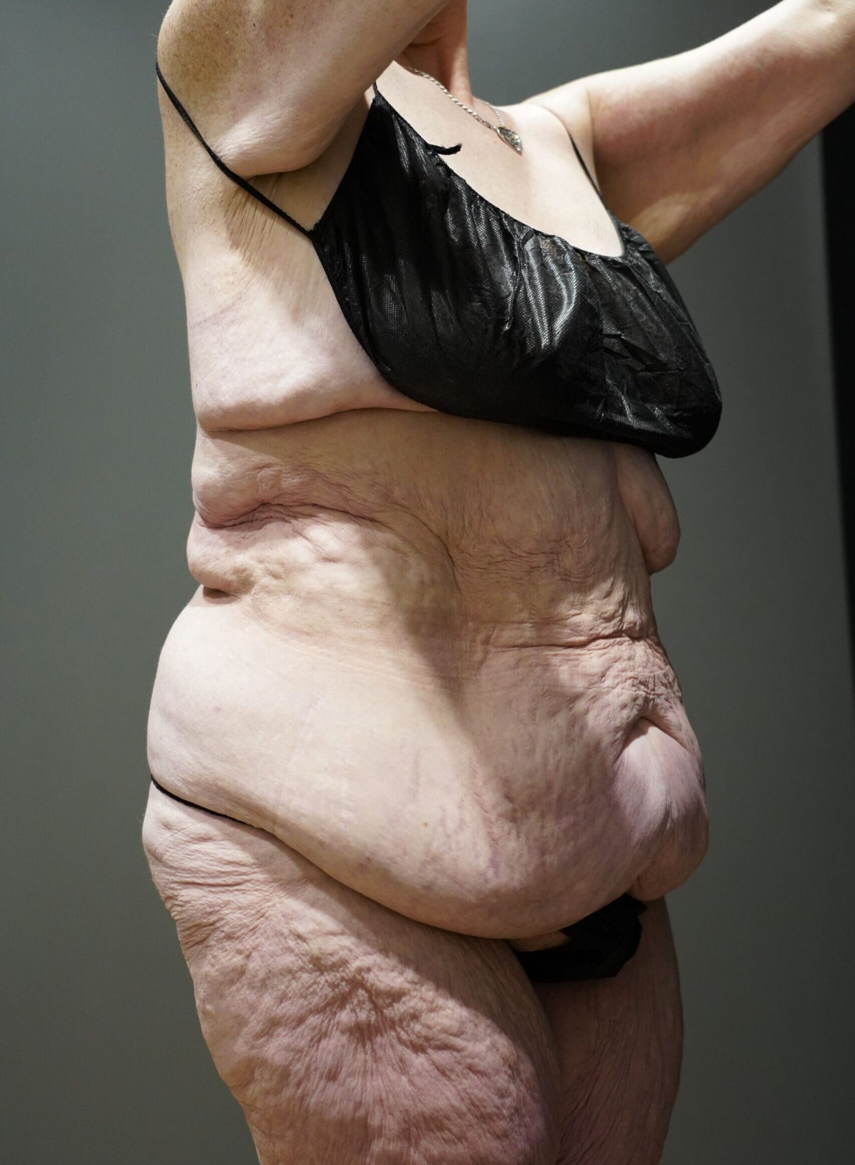 Before photo - 45° view