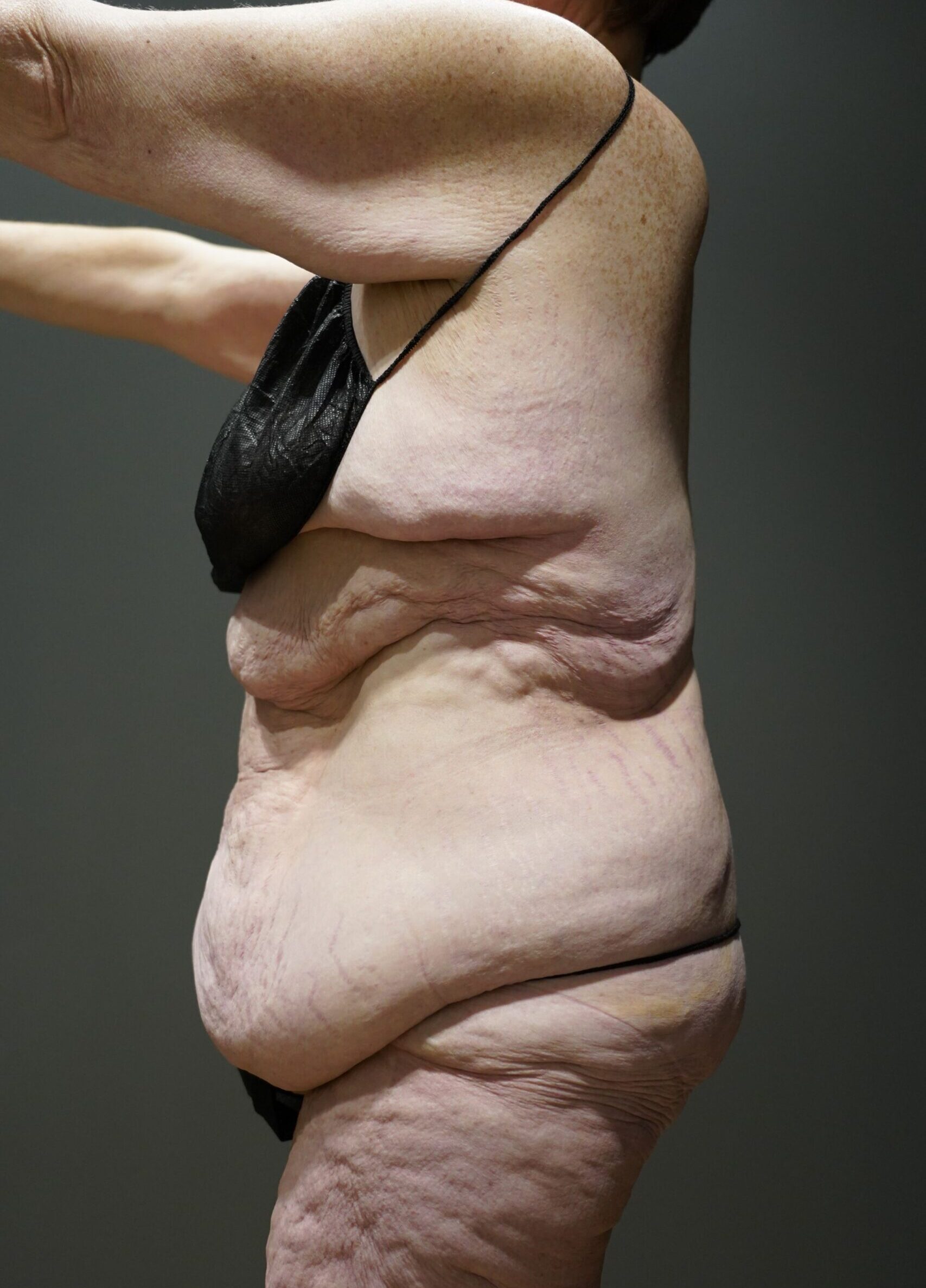 Before photo - -90° view