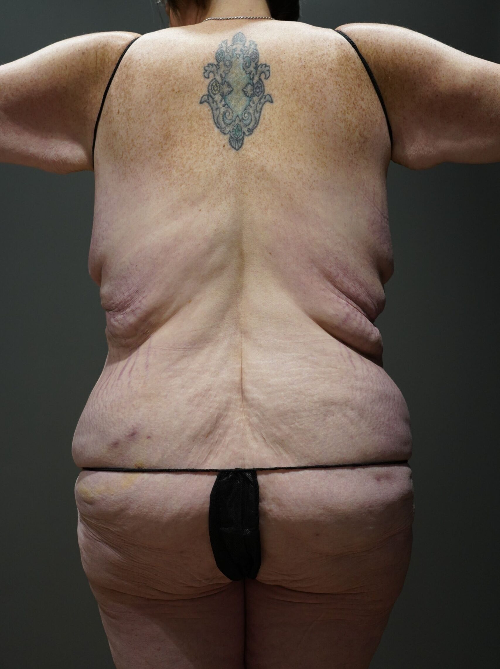 Before photo - 180° view