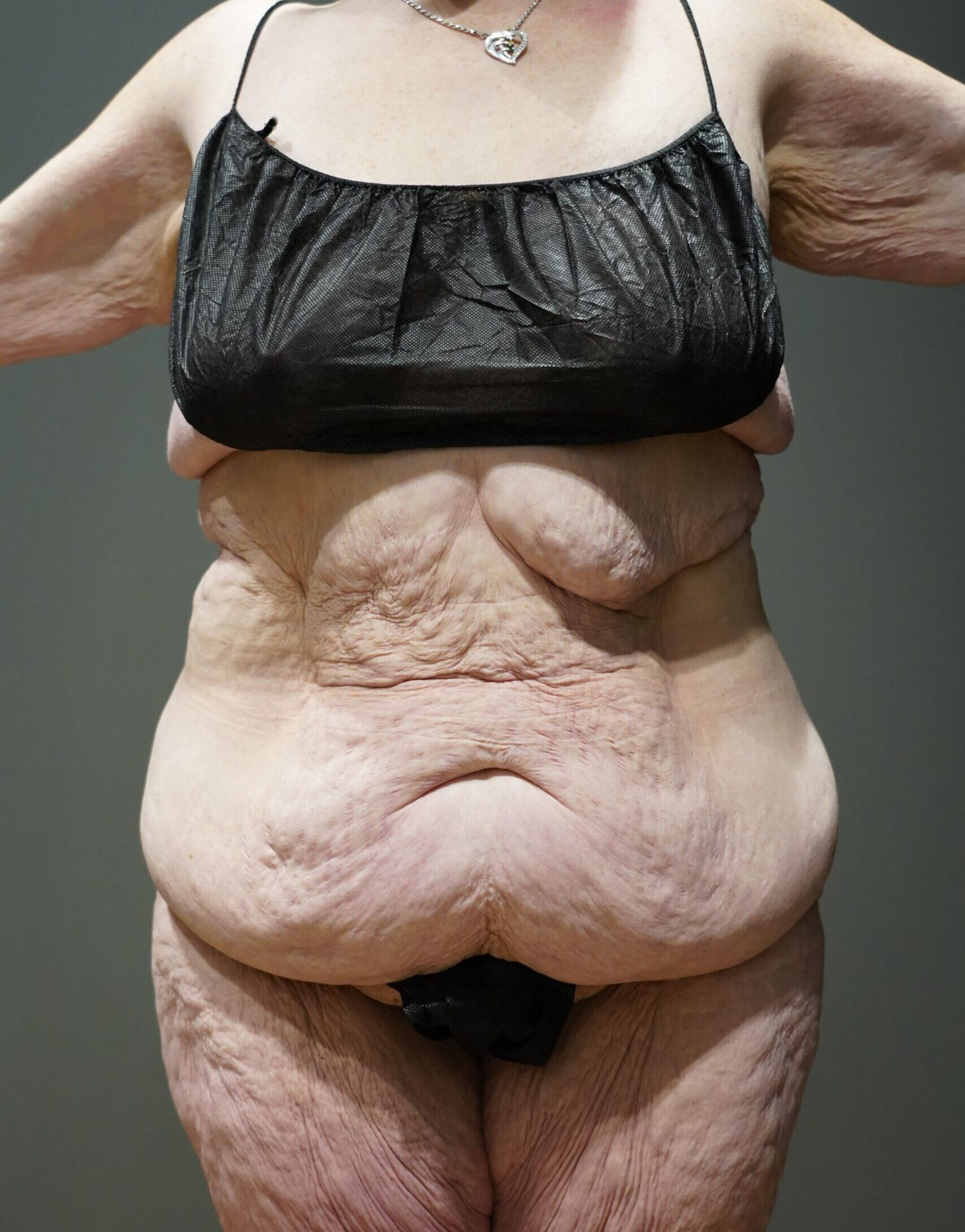 Before photo - 0° view